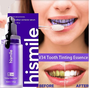 Teeth Whitening Serum V34 – Instant Brightening & Stain Corrector 30ml